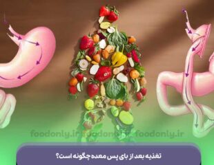 تغذیه بعد از بای پس معده