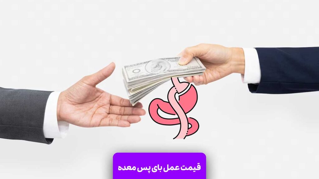 قیمت عمل بای پس معده