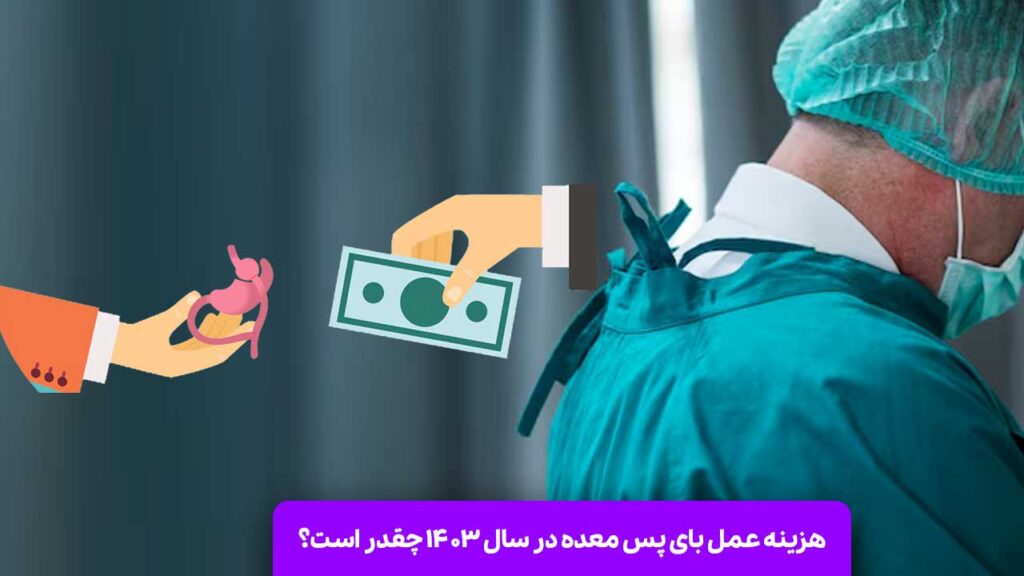 هزینه عمل بای پس معده