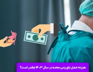 هزینه عمل بای پس معده