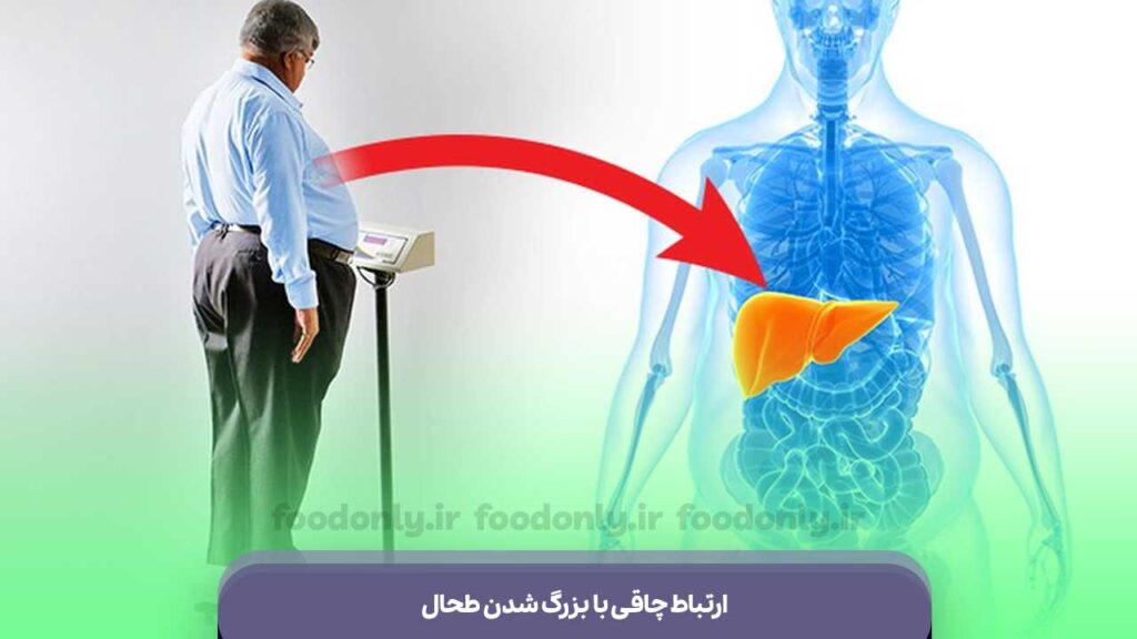 ارتباط چاقی با بزرگ شدن طحال