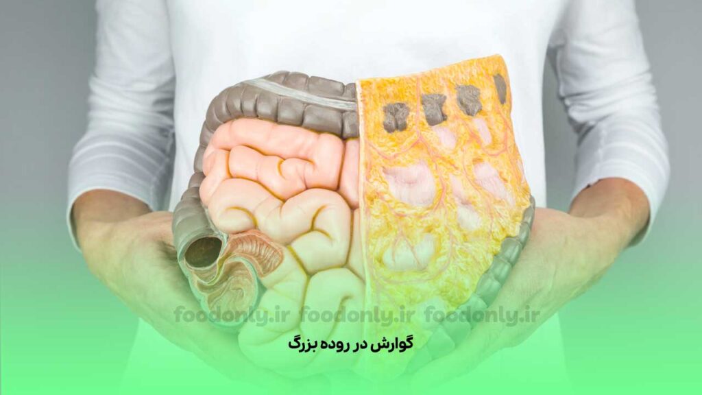 گوارش در روده بزرگ