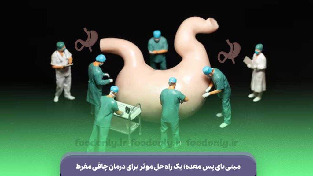 مینی بای پس معده