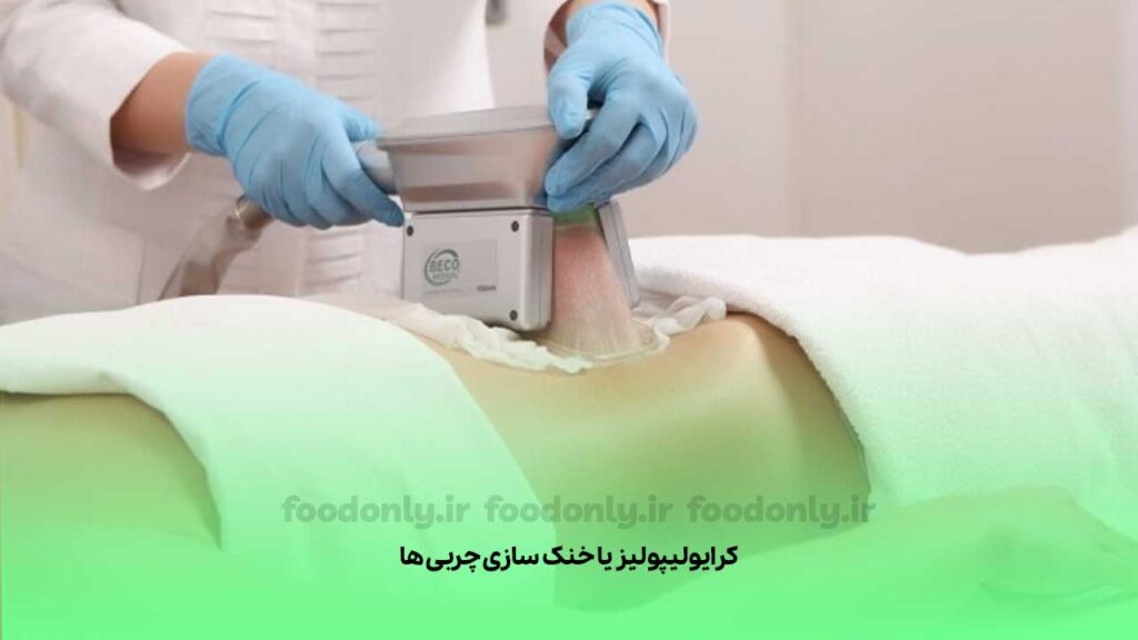 کرایولیپولیز یا خنک سازی چربی ها